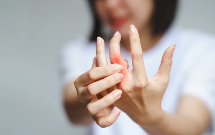 Rheumatoid Arthritis